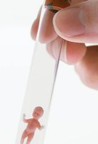 在上海仁济医院做试管婴儿，你必须得知道这些...