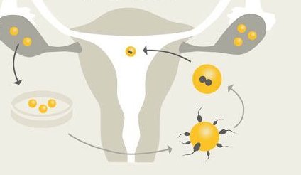 重度宫腔粘连在招远市做试管婴儿靠谱吗，重度宫腔粘连试管婴儿成功率多少！